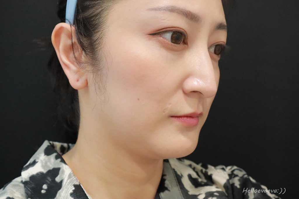 醫美|「賦真妍藍色沙龍概念店」小資女低預算也能擁有小V臉!INMODE鑽石超塑輕鬆拉回輪廓線條、拍照零死角 - 第9張圖